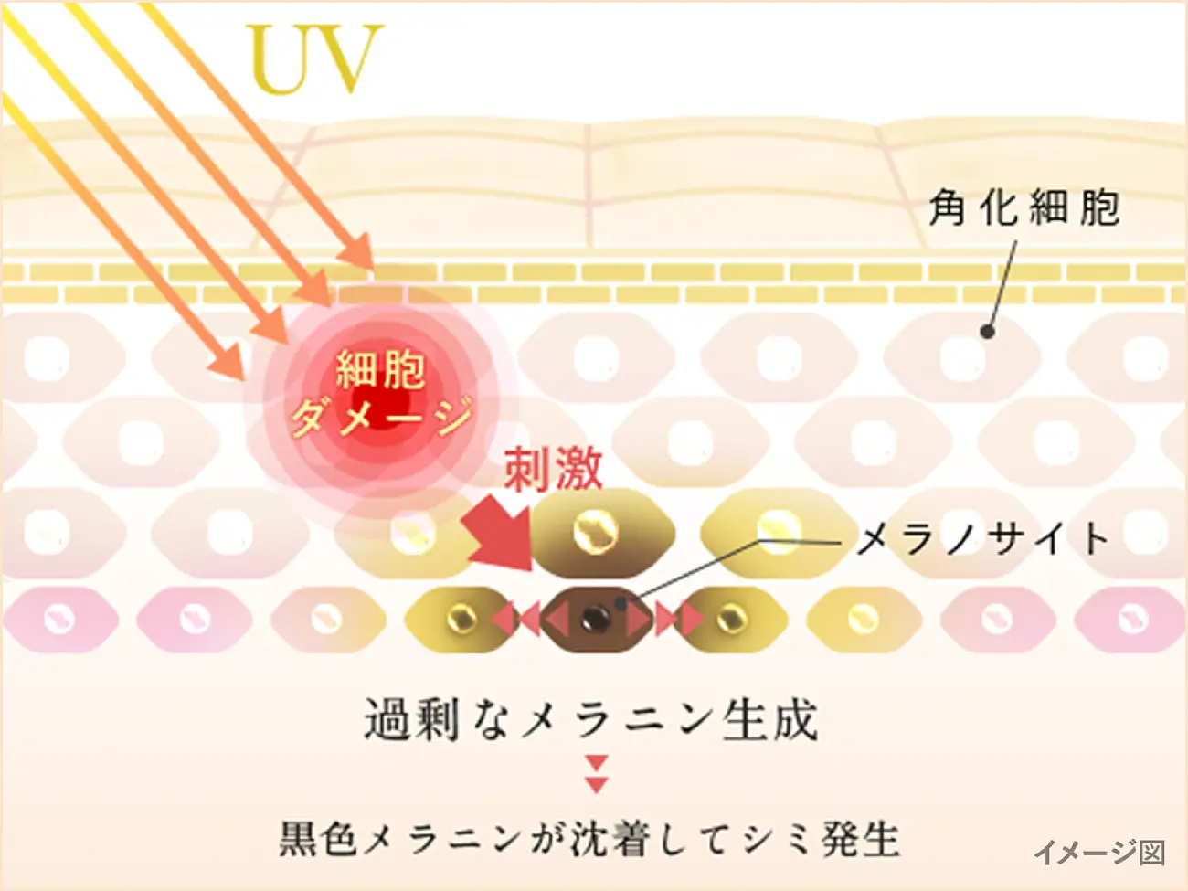イメージ図:UV 細胞ダメージ メラノサイトに刺激 過剰なメラニン生成 黒色メラニンが沈着してシミ発生