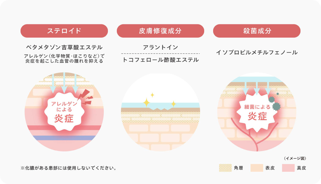 【1.ステロイド】ベタメタゾン吉草酸エステル 「アレルゲン（化学物質・ほこりなど）で炎症を起こした血管の腫れを抑える」 【2.皮膚修復成分】アラントイン、トコフェロール酢酸エステル 【3.殺菌成分】イソプロピルメチルフェノール ※化膿がある患部には使用しないでください。